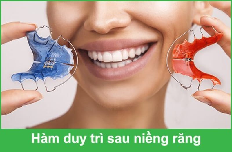 Sau khi tháo niềng và đeo hàm duy trì là đã hoàn thành quá trình niềng răng