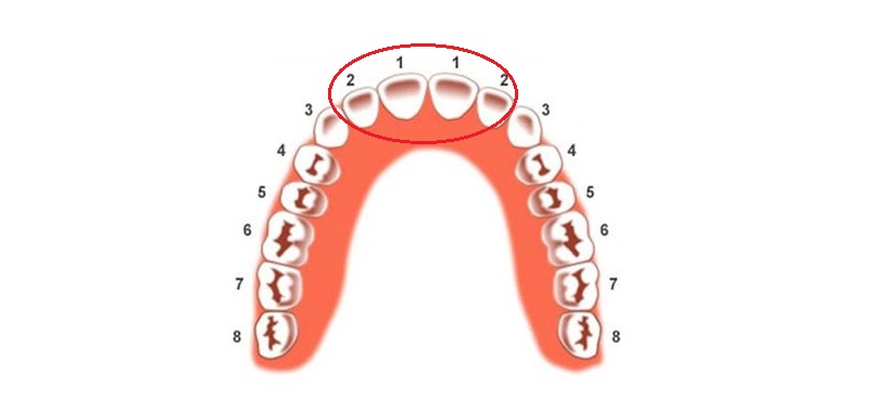 Có 4 răng cửa trên 1 hàm răng