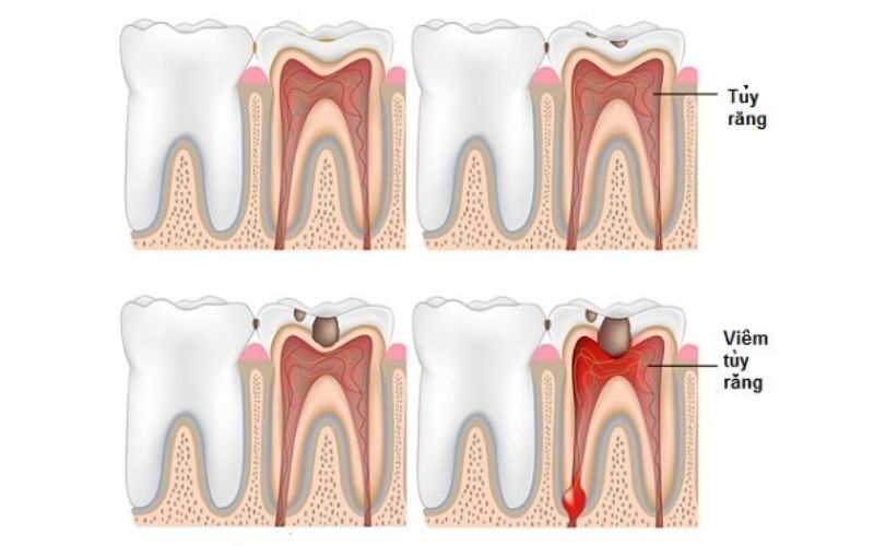 Tình trạng nhiễm trùng, sung huyết khá phổ biến