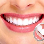 Răng sứ Zirconia là gì? Phân loại, đối tượng sử dụng và chi phí