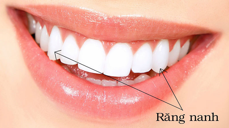 Răng số 3 nằm khá gần răng cửa