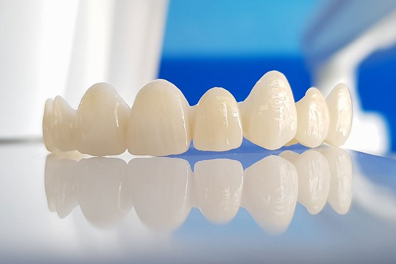 Răng sứ Zirconia không gây đen viền nướu