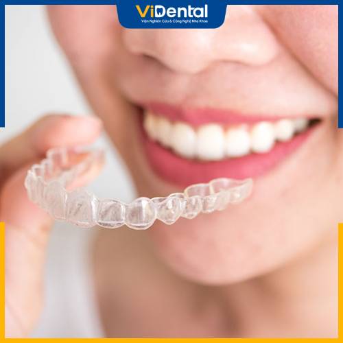 nieng-rang-invisalign-2.jpg