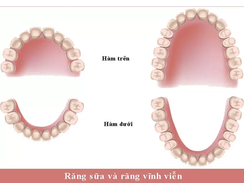 Thời gian nào bé bắt đầu mọc răng vĩnh viễn?