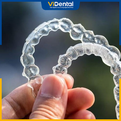 Niềng răng Invisalign có mức giá cao nhưng hiệu quả tối ưu