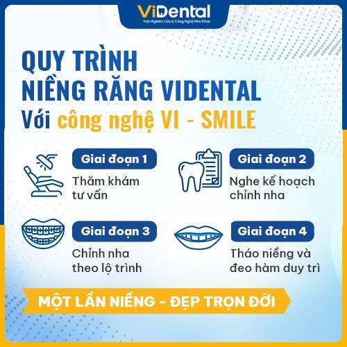 quy-trinh-nieng-vi-smile.jpg