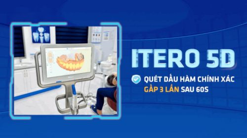 Thiết bị quét dấu răng iTero 5D