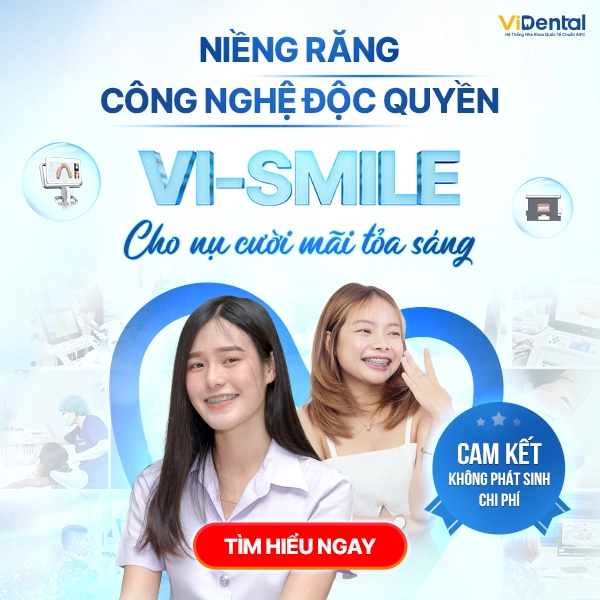 anh-banner-mac-dinh