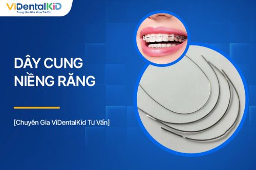 Dây Cung Niềng Răng Và Các Vấn Đề Thường Gặp Khi Sử Dụng