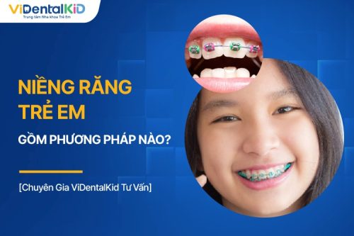 Niềng Răng Trẻ Em Có Phương Pháp Nào? Chi Phí Bao Nhiêu?