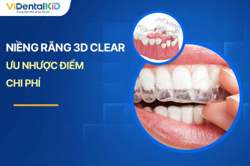 Niềng Răng 3D Clear Là Gì? Ưu Nhược Điểm Và Chi Phí Mới Nhất