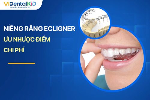 Niềng Răng Ecligner: Ưu Nhược Điểm, Chi Phí Và Lưu Ý Cần Nhớ