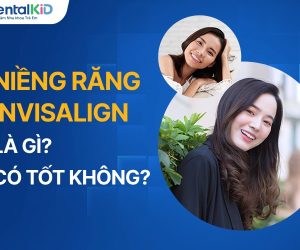 Niềng răng Invisalign là gì? Có hiệu quả không?