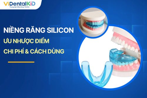 Niềng Răng Silicon: Ưu Nhược Điểm, Chi Phí Và Cách Dùng