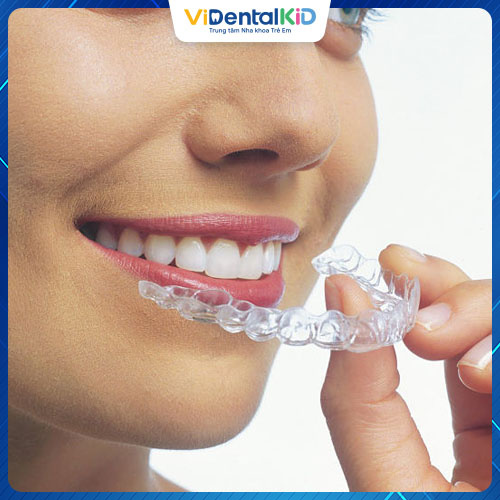 Niềng răng Clear Aligner được nhiều người lựa chọn 