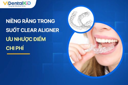 Niềng Răng Vô Hình Clear Aligner: Ưu Nhược Điểm, Chi Phí