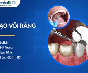 Cạo Vôi Răng: Lợi Ích, Đối Tượng, Quy Trình Và Bảng Giá Chi Tiết