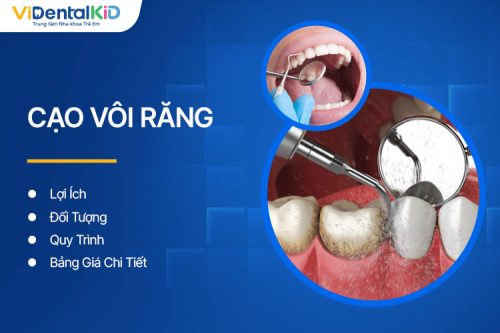 Cạo Vôi Răng: Lợi Ích, Đối Tượng, Quy Trình Và Bảng Giá Chi Tiết