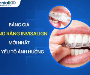 Bảng Giá Niềng Răng Invisalign Mới Nhất Và Yếu Tố Ảnh Hưởng