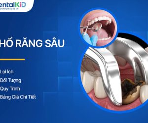 Nhổ Răng Sâu: Lợi Ích, Đối Tượng, Quy Trình Và Bảng Giá