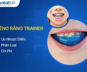 Niềng Răng Trainer Là Gì? Ưu Nhược Điểm, Phân Loại, Chi Phí