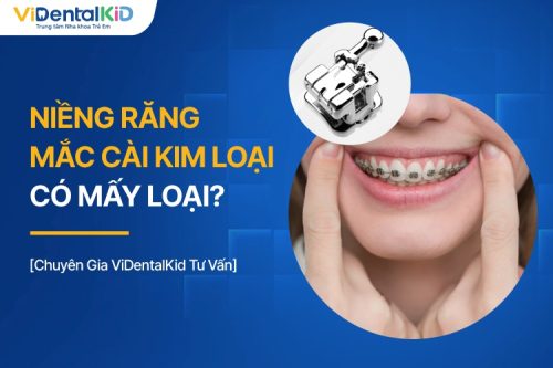 Niềng Răng Mắc Cài Kim Loại Có Mấy Loại? Chi Phí Bao Nhiêu?