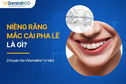 Niềng Răng Mắc Cài Pha Lê Là Gì? Có Tốt Không?